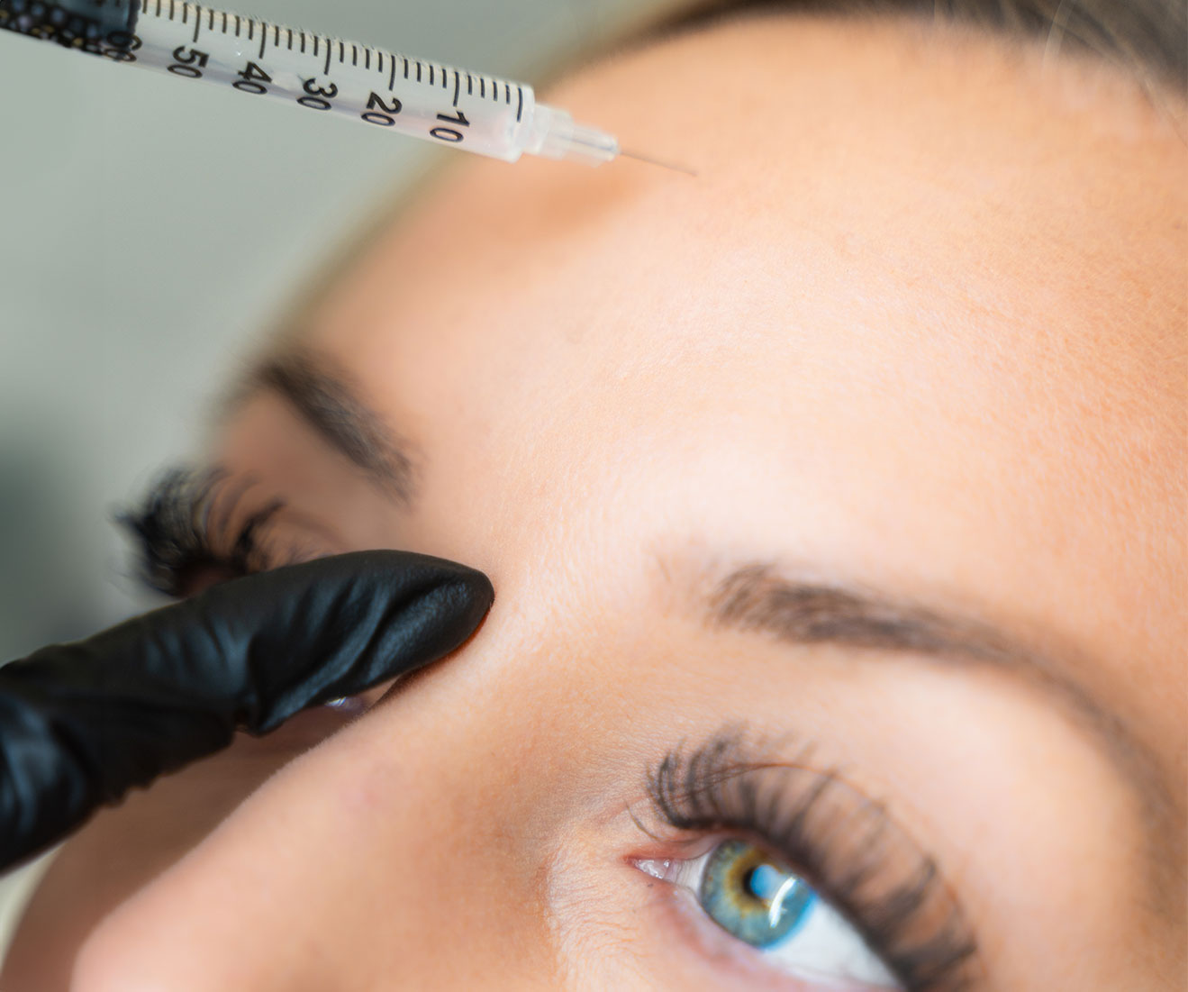 Botox treatment at Opal Aesthetics