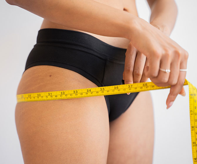 Excess Weight treatment in Bakersfield