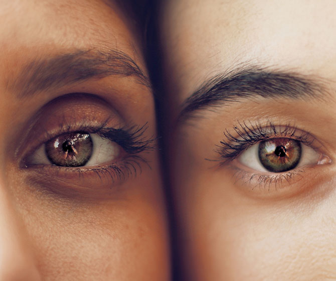 Facial Volume Loss treatment in Bakersfield