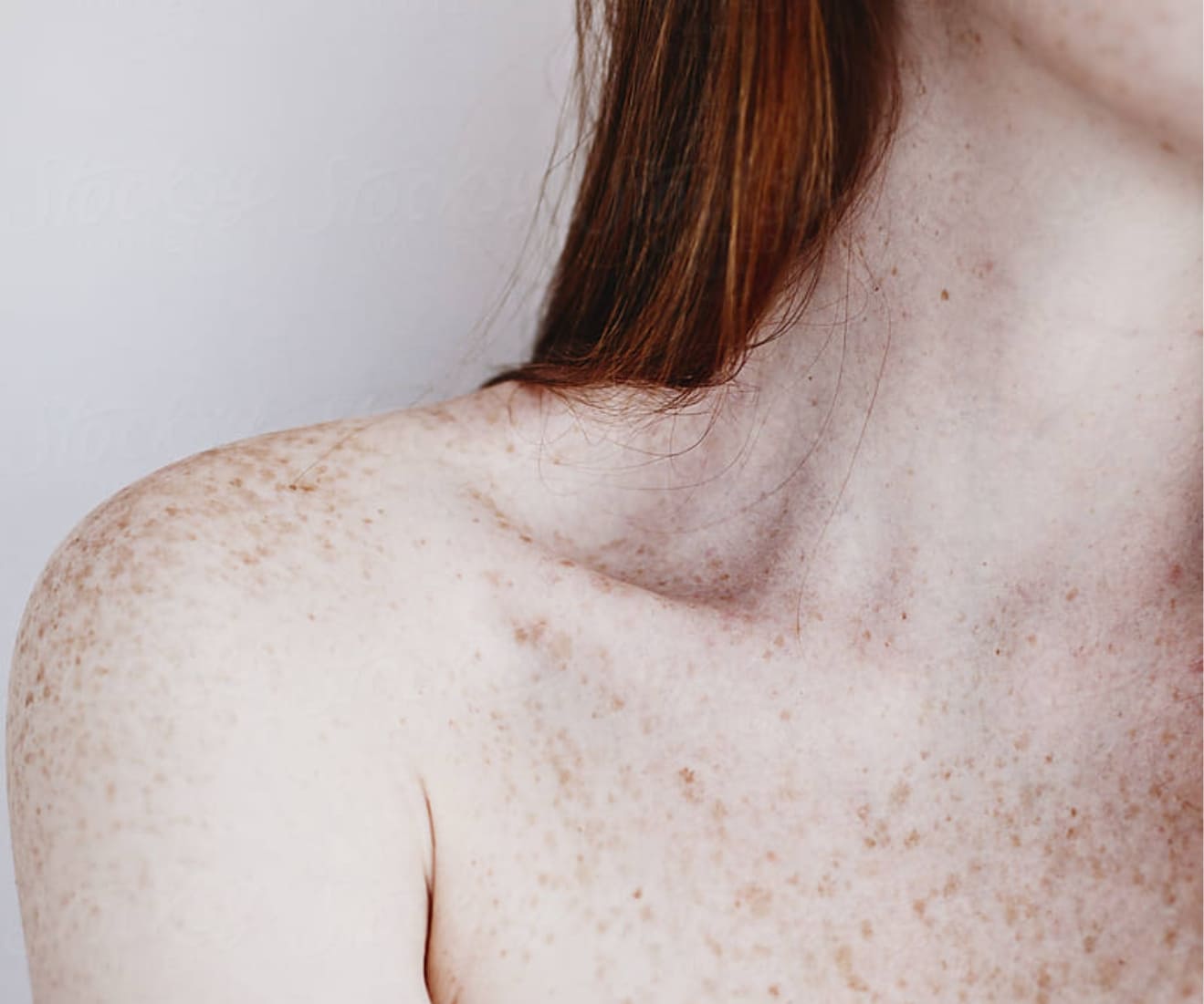 Skin and body concerns treated at Opal Aesthetics