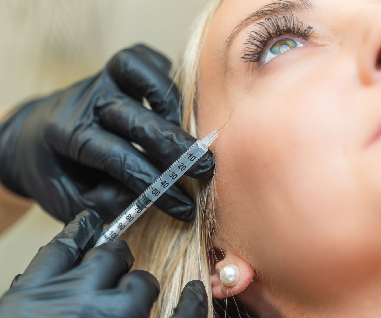 Dermal Fillers treatment at Opal Aesthetics
