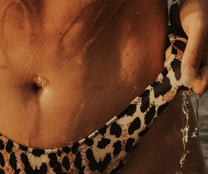 Sculptra treatment at Opal Aesthetics